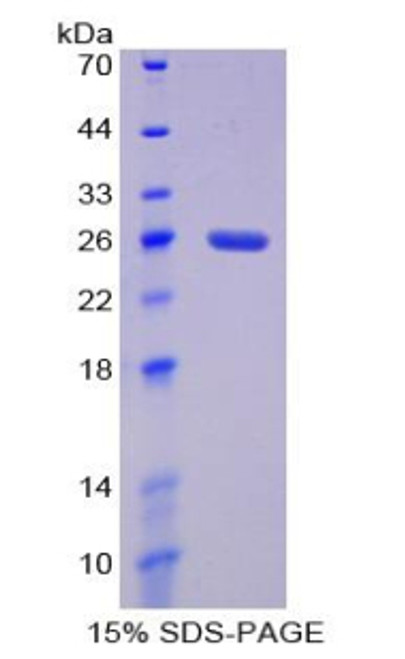 Rat Recombinant Interleukin 4 Receptor (IL4R)