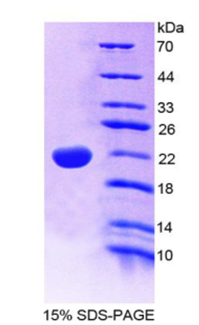 Mouse Recombinant Interleukin 22 (IL22)