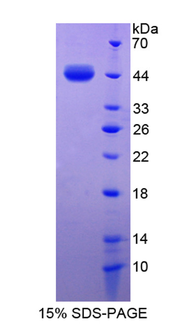 Cattle Recombinant S100 Calcium Binding Protein A7 (S100A7)