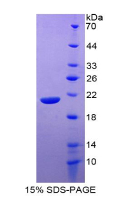 Human Recombinant Interleukin 20 (IL20)