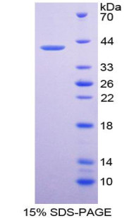Human Recombinant Interferon Inducible T-Cell Alpha Chemoattractant (ITaC)