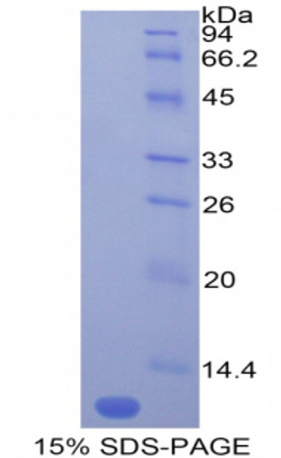 Mouse Recombinant Monocyte Chemotactic Protein 5 (MCP5)