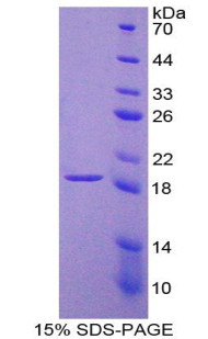 Rat Recombinant Laminin Beta 2 (LAMb2)