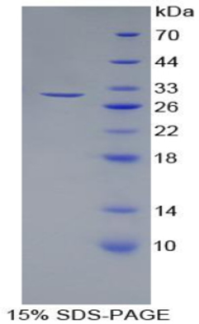 Rat Recombinant Laminin Beta 3 (LAMb3)