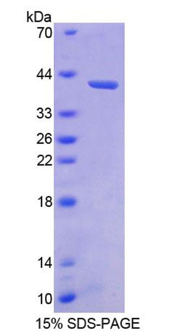 Human Recombinant Bone Morphogenetic Protein 3 (BMP3)