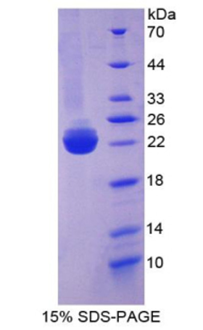 Rat Recombinant Bone Morphogenetic Protein 3 (BMP3)