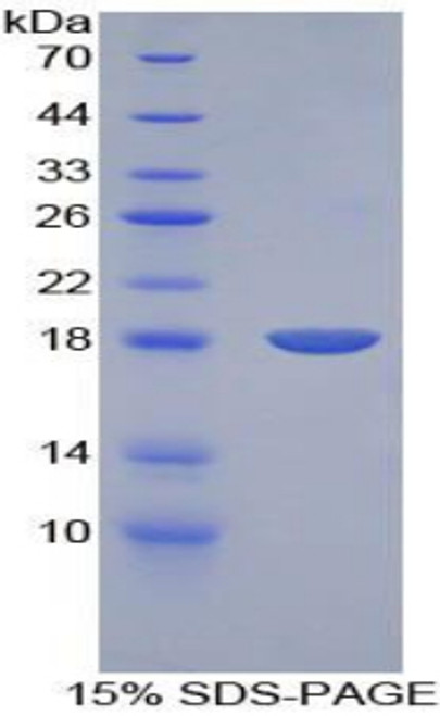 Rat Recombinant Bone Morphogenetic Protein 15 (BMP15)