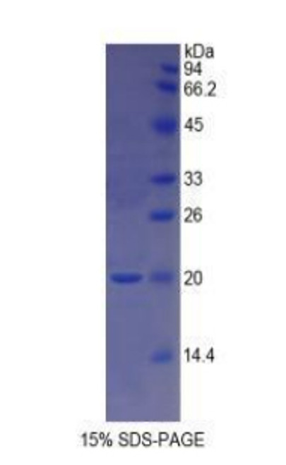 Rat Recombinant Growth Differentiation Factor 1 (GDF1)