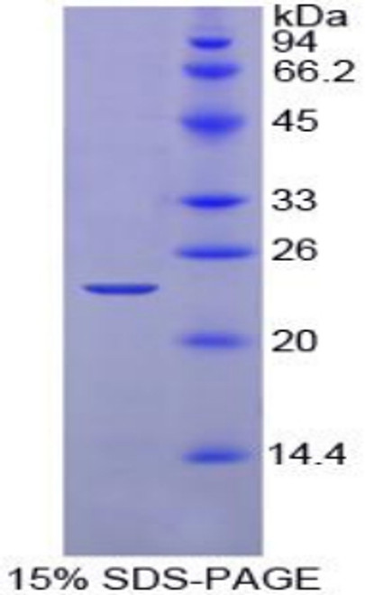 Chicken Recombinant Noggin (NOG)