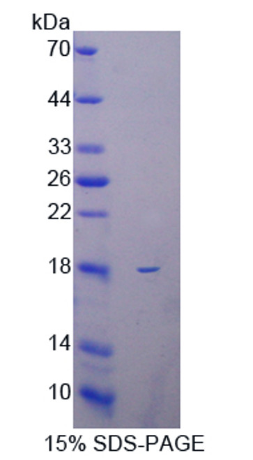 Cattle Recombinant Collagen Type X (COL10)