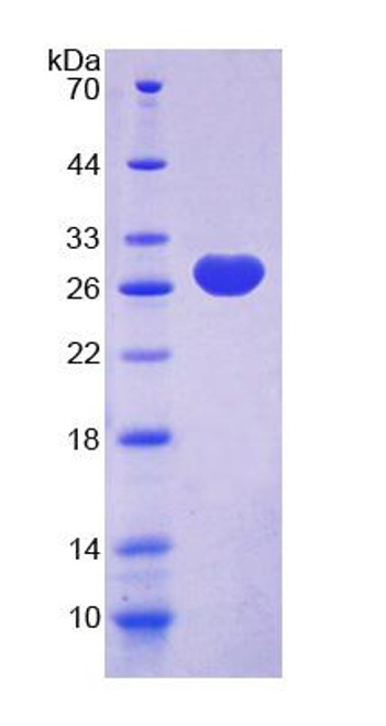 Rat Recombinant Neuregulin 2 (NRG2)