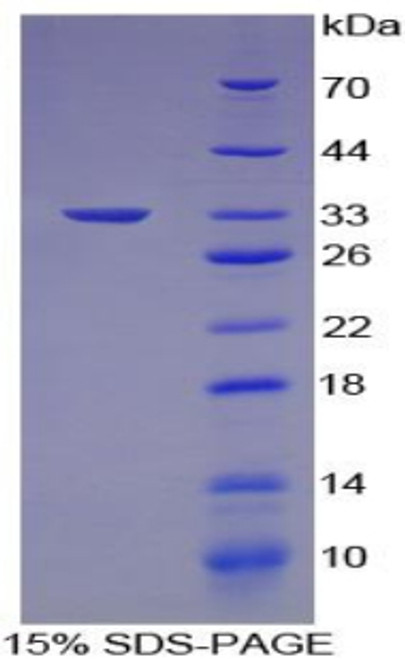 Mouse Recombinant E1A Binding Protein P300 (EP300)