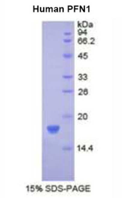 Human Recombinant Profilin 1 (PFN1)