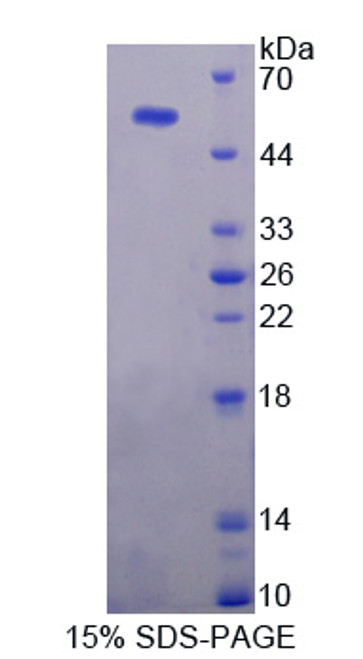 Human Recombinant Ubiquitin Specific Peptidase 7 (USP7)