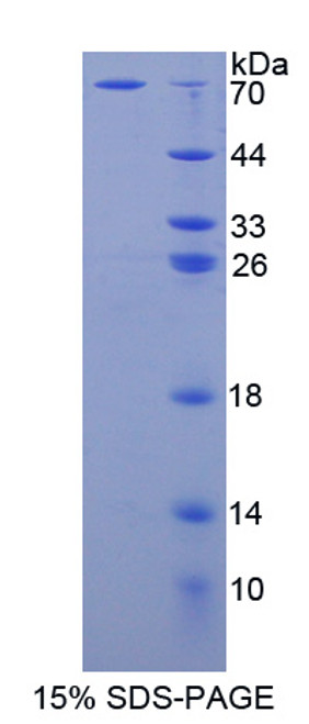 Mouse Recombinant Adenosine Kinase (ADK)