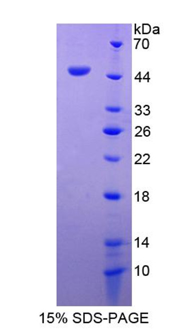 Human Recombinant Adhesion Regulating Molecule 1 (ADRM1)