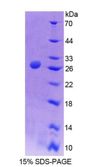 Mouse Recombinant Alanine Glyoxylate Aminotransferase (AGXT)