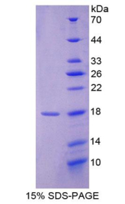 Rat Recombinant Allograft Inflammatory Factor 1 (AIF1)