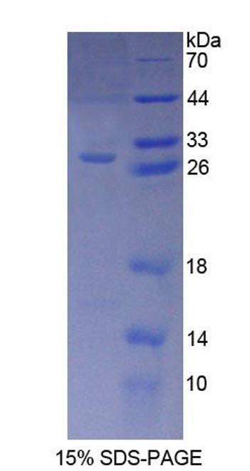 Human Recombinant Aryl Hydrocarbon Receptor Interacting Protein (AIP)