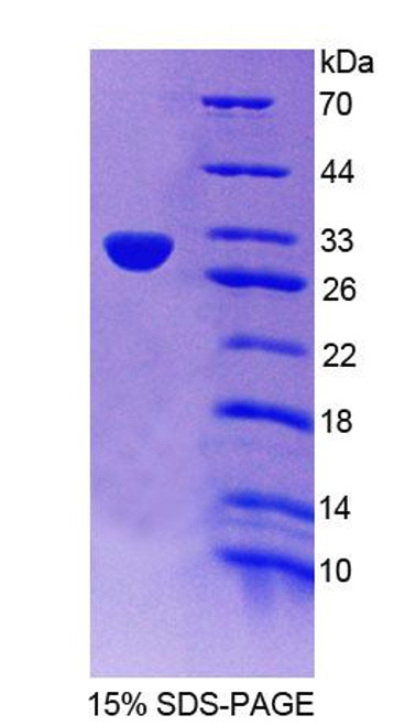 Mouse Recombinant Aurora Kinase C (AURKC)