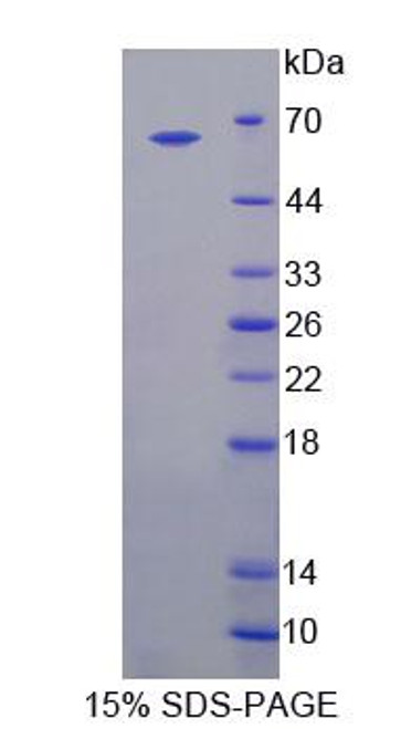 Human Recombinant Bestrophin 1 (BEST1)