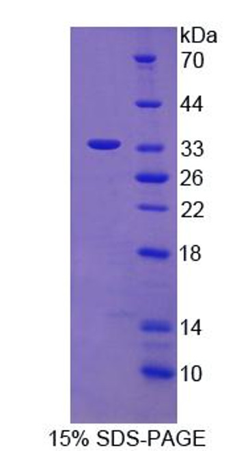 Human Recombinant Centrosomal Protein 110kDa (CEP110)