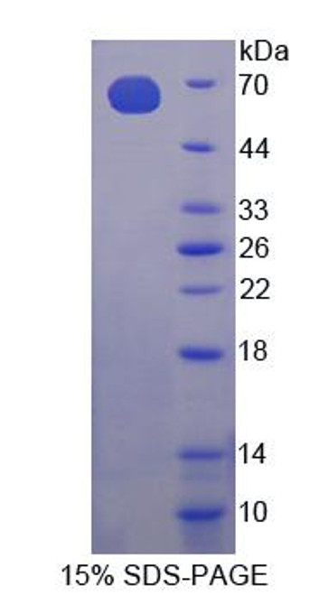 Mouse Recombinant Choline Kinase Alpha (CHKa)