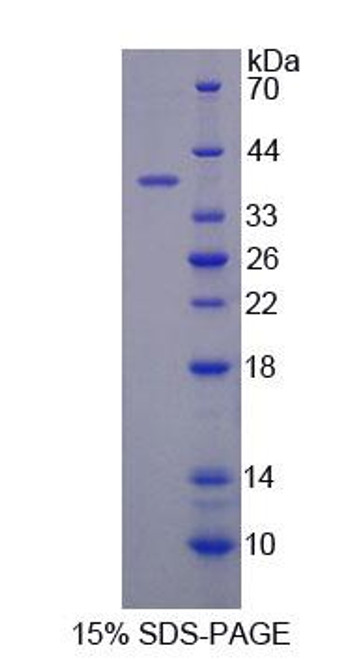 Human Recombinant Cytochrome C Oxidase Subunit VIc (COX6c)