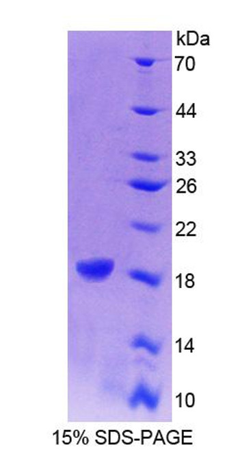 Human Recombinant Cellular Retinoic Acid Binding Protein 1 (CRABP1)