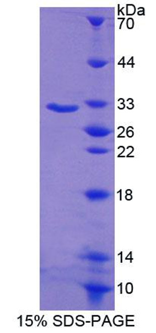 Human Recombinant C-Terminal Binding Protein 1 (CTBP1)