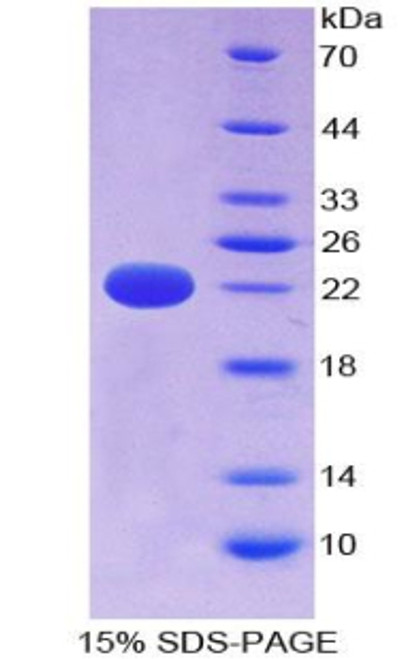 Human Recombinant Cylindromatosis (CYLD)