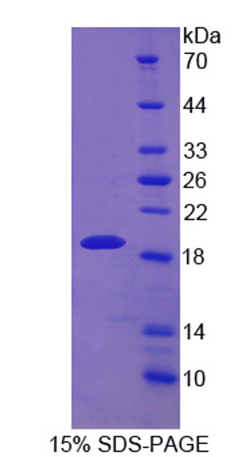 Human Recombinant Drebrin 1 (DBN1)