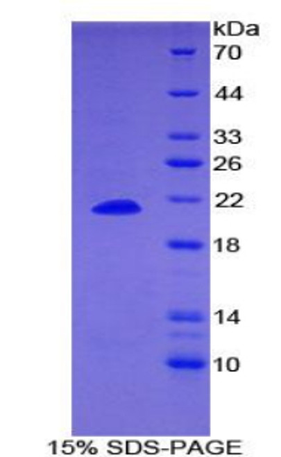 Human Recombinant Dermatopontin (DPT)