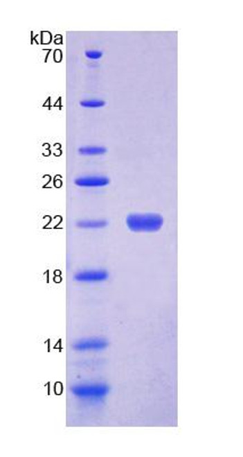 Human Recombinant Dyskerin (DKC)