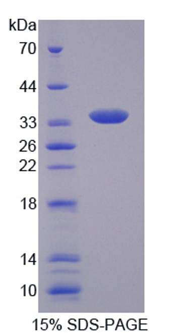 Human Recombinant Endonuclease G, Mitochondrial (ENDOG)