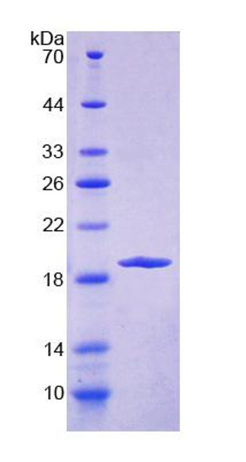 Human Recombinant Endoplasmic Reticulum Protein 29 (ERP29)