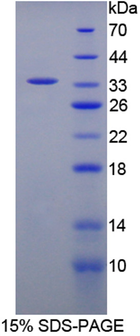 Cattle Recombinant Fibrinogen Gamma (FGg)