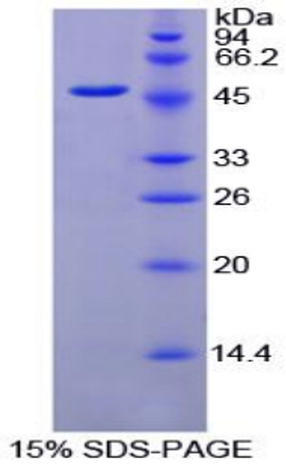 Chicken Recombinant Fibrinogen Gamma (FGg)