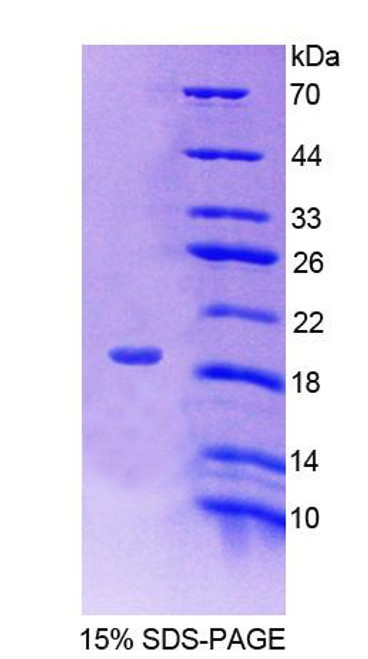 Human Recombinant FK506 Binding Protein 2 (FKBP2)