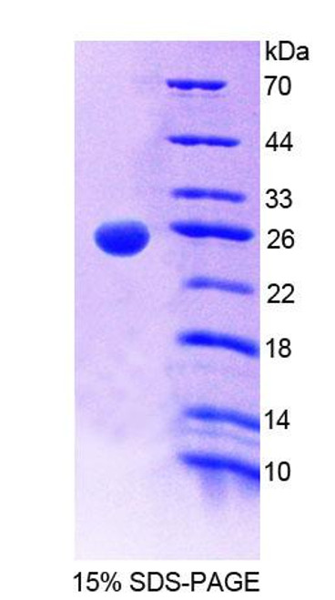 Mouse Recombinant Grancalcin (GCA)