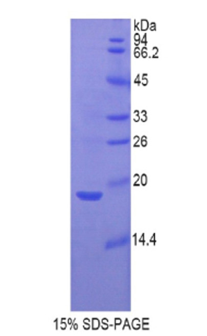 Pig Recombinant Gastrokine 1 (GKN1)