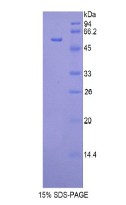 Mouse Recombinant Glucosidase Beta, Acid (GbA)