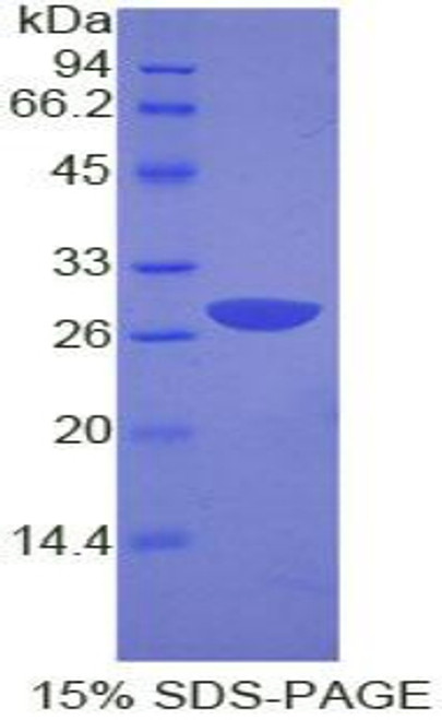 Human Recombinant Growth Factor Receptor Bound Protein 2 (Grb2)