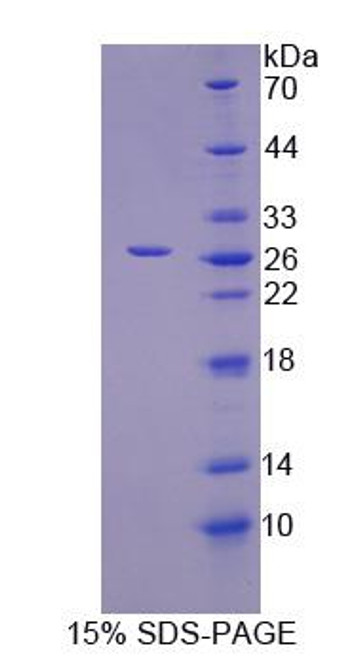 Human Recombinant InosineTriphosphatase(ITPA)