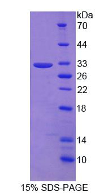 Mouse Recombinant Leucine Rich Repeats And Death Domain Containing Protein (LRDD)