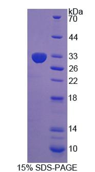 Rat Recombinant Leucine Rich Repeats And Death Domain Containing Protein (LRDD)