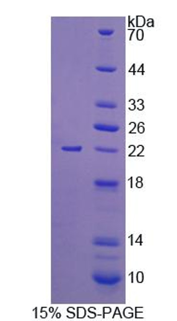 Mouse Recombinant Uridine Monophosphate Synthetase (UMPS)