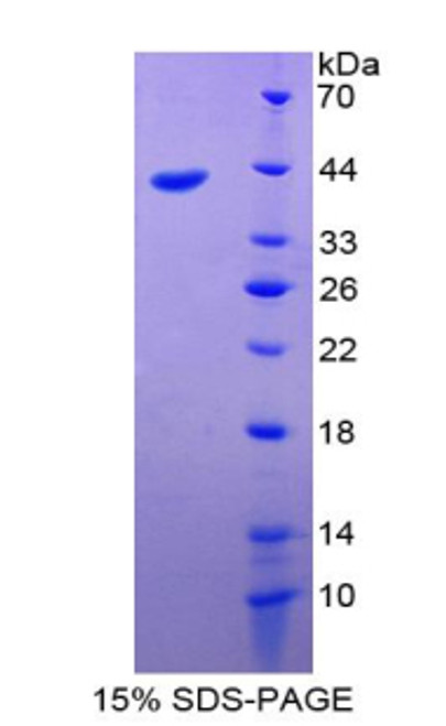 Human Recombinant Villin 1 (VIL1)