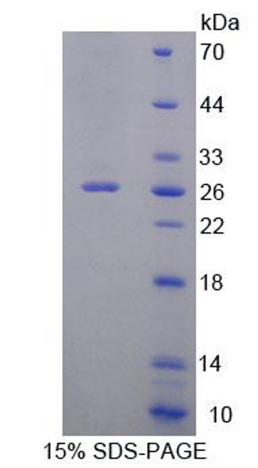 Human Recombinant Zuotin Related Factor 1 (ZRF1)