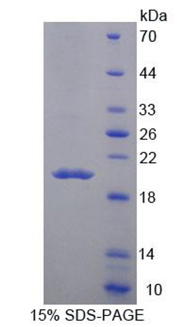 Mouse Recombinant Macrophage Receptor With Collagenous Structure (MARCO)